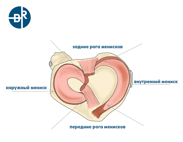 москва мениск