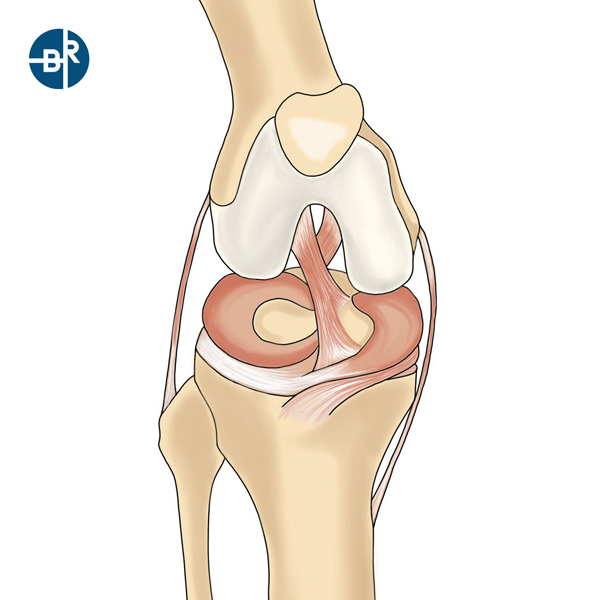 коленный мениск