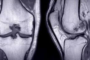 рентген кт мрт