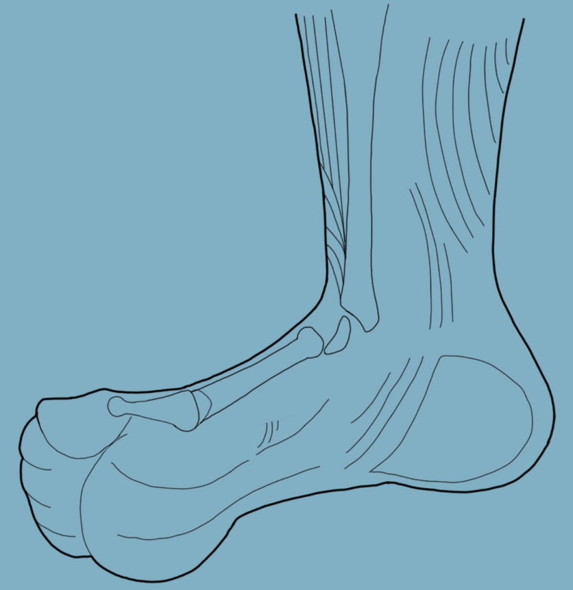 реабилитация голеностопных суставов