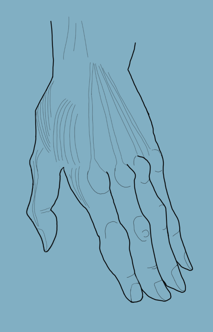 кистевая терапия москва